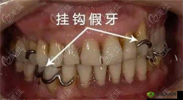 17C 一起槽相关话题探讨